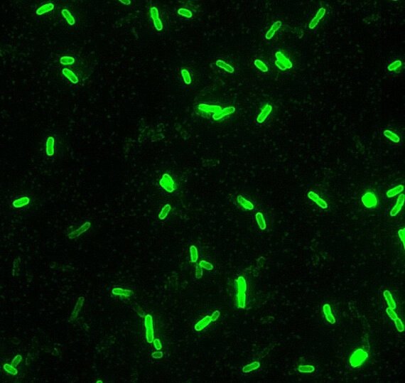 Recombinant Chicken Putative homeodomain transcrip ...